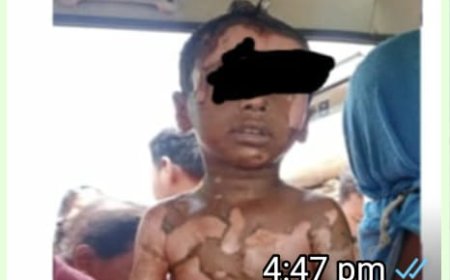 ।। ଗରମ ଖିରିରେ ପଡ଼ି ଶିଶୁର ମୃତ୍ୟୁ ।।