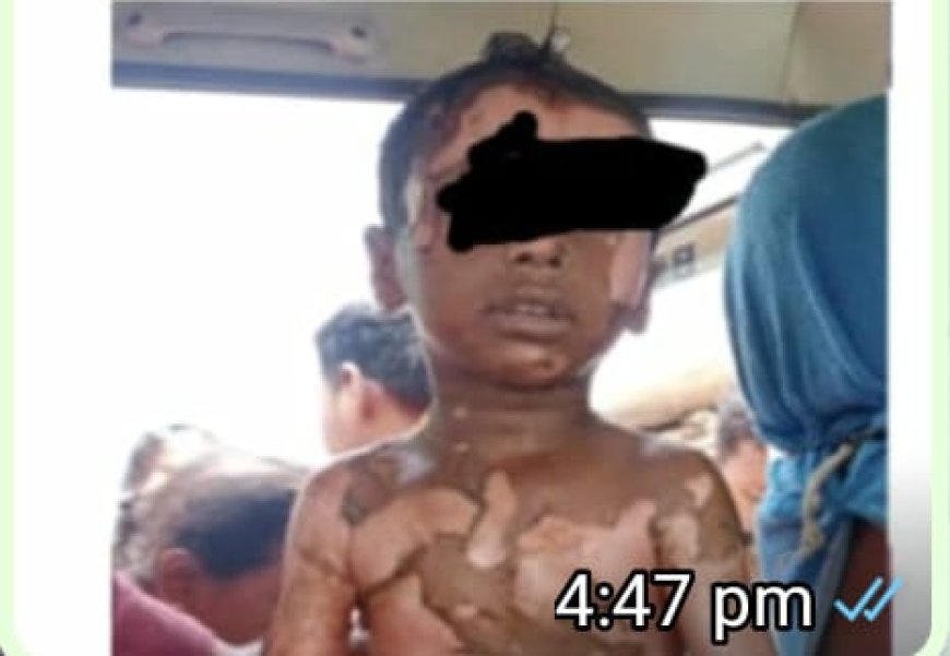 ।। ଗରମ ଖିରିରେ ପଡ଼ି ଶିଶୁର ମୃତ୍ୟୁ ।।