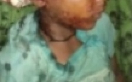 ।। ଜ଼ିଲ୍ଲାରେ ପୁଣି ବାଘ ଆତଙ୍କ ସାତ ବର୍ଷର ନାବାଳକକୁ  ଖାଇଗଲା ବାଘ ।।