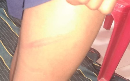 ।। ଦଣ୍ଡ ମୁକ୍ତ ଅଞ୍ଚଳ ରେ ଛାତ୍ରଛାତ୍ରୀ ଙ୍କୁ ଦଣ୍ଡ। ଉଆ ଉଆ ରେ ସରକାରଙ୍କ ।।