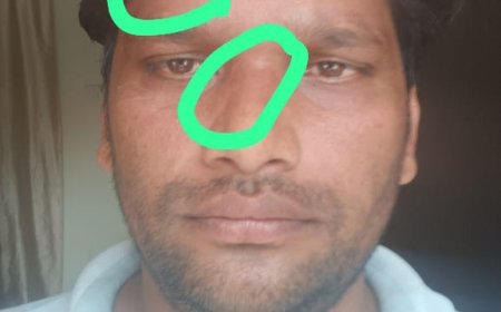 ।। ସମାଜସେବୀ ତଥା ବିଜେପି ର ଯୁବ ନେତା ଙ୍କୁ ଆକ୍ରମଣ ।।