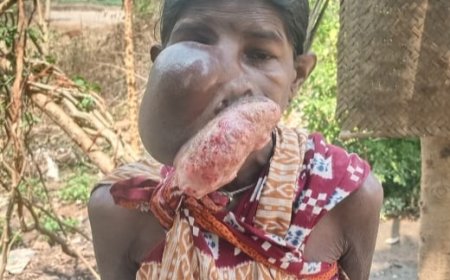 ଦୀର୍ଘ ବର୍ଷ ହେବ କର୍କଟ ପୀଡ଼ିତା ଯୁଜୁଛନ୍ତି  ଚିକିତ୍ସା ଲାଗି ଏପଟେ ଅର୍ଥ ସାଜିଛି ବାଧକ