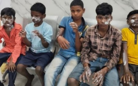 ଆକାଶ ରୁ ବେଲୁନ ଖସି ଧରିଲାବେଳକୁ, ୫ ନାବାଳକ ଆହତ