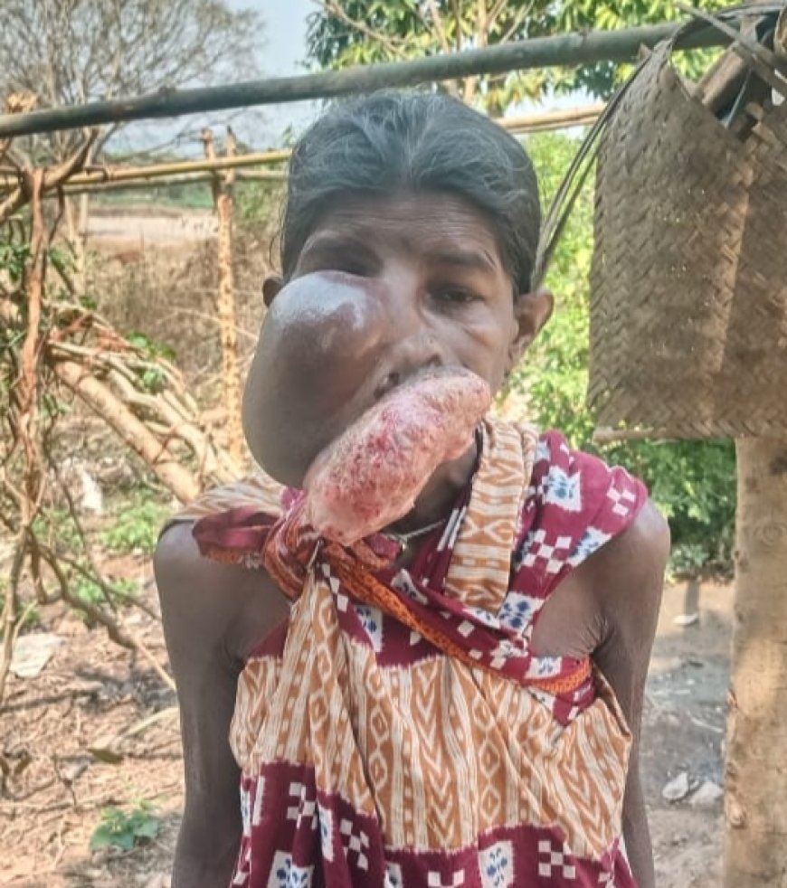 ଦୀର୍ଘ ବର୍ଷ ହେବ କର୍କଟ ପୀଡ଼ିତା ଯୁଜୁଛନ୍ତି ଚିକିତ୍ସା ଲାଗି ଏପଟେ ଅର୍ଥ ସାଜିଛି ବାଧକ