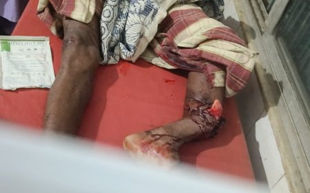 ଅଜଣା ବାଇକ ଧକ୍କାରେ ଜଣେ ଗୁରୁତର