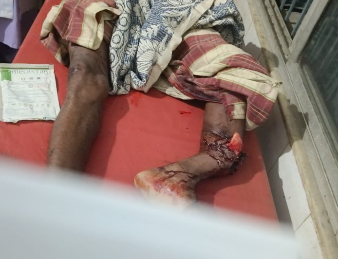 ଅଜଣା ବାଇକ ଧକ୍କାରେ ଜଣେ ଗୁରୁତର