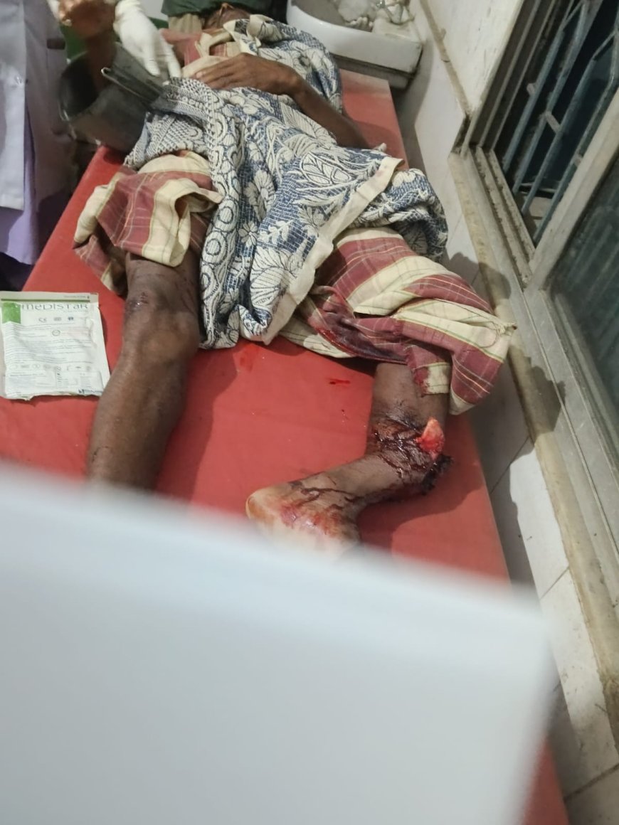 ଅଜଣା ବାଇକ ଧକ୍କାରେ ଜଣେ ଗୁରୁତର